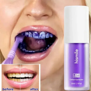 Blanqueador Dental Morada v34